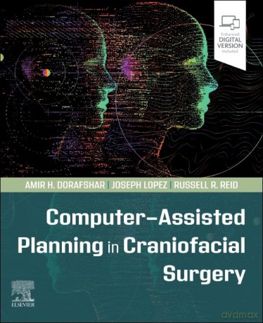 Computer-Assisted Planning in Craniofacial Surgery - Amir H Dorafshar [KSIĄŻKA]