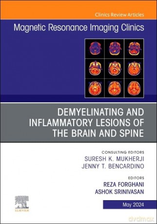 Demyelinating and Inflammatory Lesions of the Brain and Spine, An Issue of Magnetic Resonance Imaging Clinics of North America (Volume 32-2) (The Clinics: Radiology, Volume 32-2) - Reza Forghani [KSIĄŻKA]