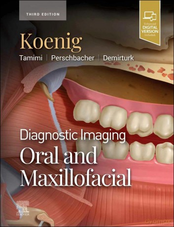 Diagnostic Imaging: Oral and Maxillofacial - Lisa J. Koenig [KSIĄŻKA]