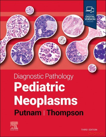 Diagnostic Pathology: Pediatric Neoplasms - Angelica R. Putnam [KSIĄŻKA]