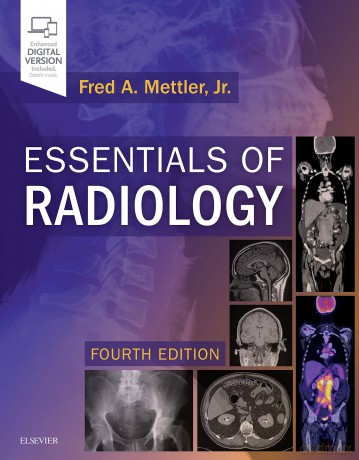 Essentials of Radiology: Common Indications and Interpretation - Fred Mettler [KSIĄŻKA]