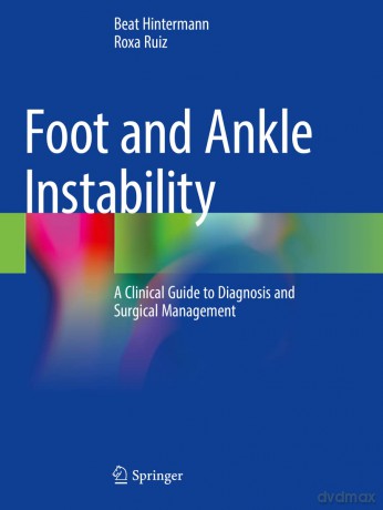 Foot and Ankle Instability: A Clinical Guide to Diagnosis and Surgical Management - Beat Hintermann [KSIĄŻKA]