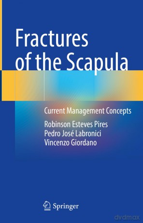 Fractures of the Scapula: Current Management Concepts - Robinson Este Pires [KSIĄŻKA]