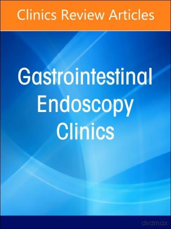 Gastrointestinal Bleeding, An Issue of Gastrointestinal Endoscopy Clinics (Volume 34-2) (The Clinics: Internal Medicine, Volume 34-2) - Patrick Pfau [KSIĄŻKA]