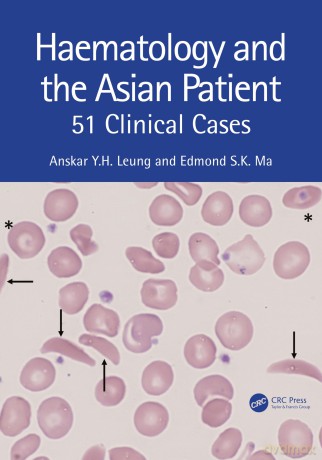 Haematology and the Asian Patient: 51 Clinical Cases - Leung Anskar Y.H. [KSIĄŻKA]