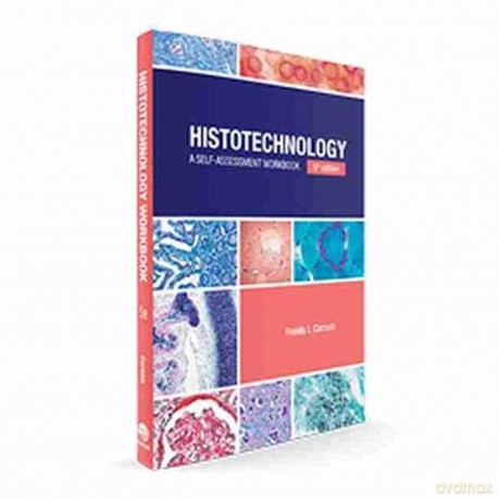Histotechnology: A Self-Assessment Workbook - Carson Freida L. [KSIĄŻKA]