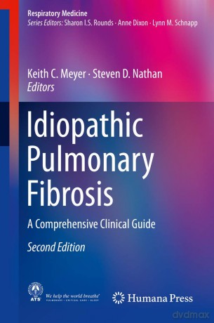 Idiopathic Pulmonary Fibrosis: A Comprehensive Clinical Guide (Respiratory Medicine) - Meyer [KSIĄŻKA]