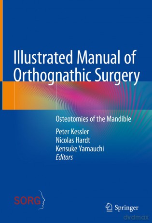 Illustrated Manual of Orthognathic Surgery: Osteotomies of the Mandible - Peter Kessler [KSIĄŻKA]