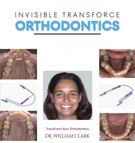 Invisible TransForce Orthodontics - Dr. William Clark [KSIĄŻKA]
