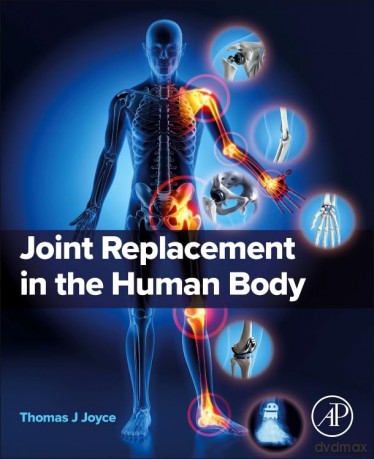 Joint Replacement in the Human Body - Thomas J. Joyce [KSIĄŻKA]