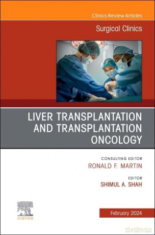 Liver Transplantation and Transplantation Oncology, An Issue of Surgical Clinics (Volume 104-1) (The Clinics: Surgery, Volume 104-1) - Shimul Shah [KSIĄŻKA]