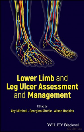 Lower Limb and Leg Ulcer Assessment and Management [KSIĄŻKA]