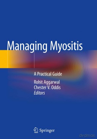 Managing Myositis: A Practical Guide - Rohit Aggarwal [KSIĄŻKA]
