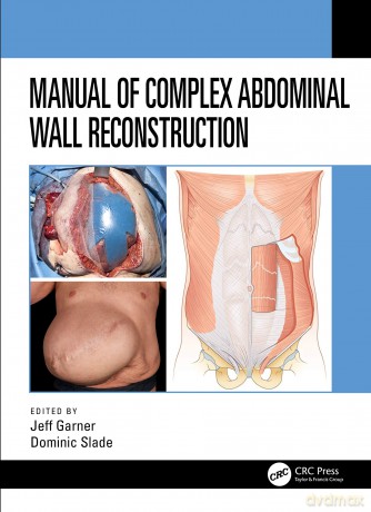 Manual of Complex Abdominal Wall Reconstruction - Jeff Garner [KSIĄŻKA]