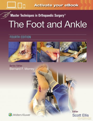 Master Techniques in Orthopaedic Surgery: The Foot and Ankle: Print + eBook with Multimedia - Scott Ellis [KSIĄŻKA]