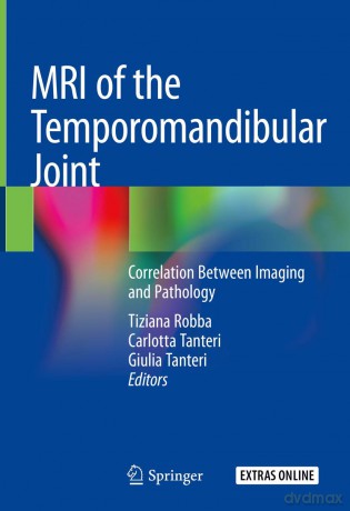 MRI of the Temporomandibular Joint: Correlation Between Imaging and Pathology - Robba [KSIĄŻKA]