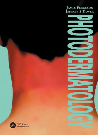 Photodermatology [KSIĄŻKA]