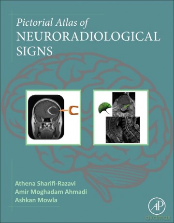 Pictorial Atlas of Neuroradiological Signs - Athen Sharifi-Razavi [KSIĄŻKA]