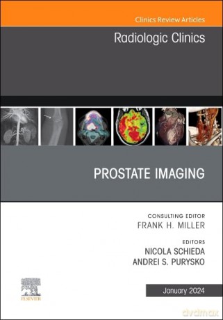 Prostate Imaging, An Issue of Radiologic Clinics of North America (Volume 62-1) (The Clinics: Radiology, Volume 62-1) - Nicola Schieda [KSIĄŻKA]
