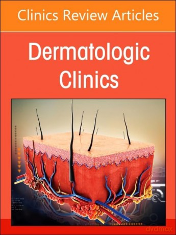 Psoriasis: Contemporary and Future Therapies, An Issue of Dermatologic Clinics (Volume 42-3) (The Clinics: Dermatology, Volume 42-3) - Jeffrey M. Cohen [KSIĄŻKA]