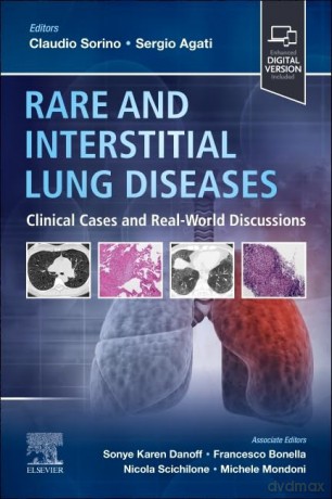 Rare and Interstitial Lung Diseases: Clinical Cases and Real-World Discussions - Claudio Sorino [KSIĄŻKA]