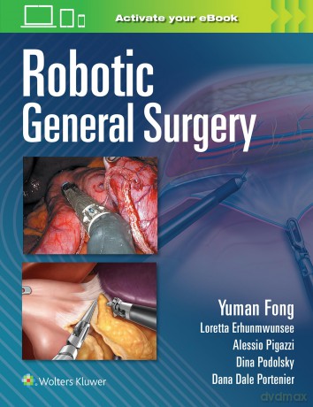 Robotic General Surgery - Yuman, Fong [KSIĄŻKA]