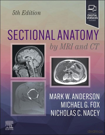 Sectional Anatomy by MRI and CT - Mark W. Anderson [KSIĄŻKA]