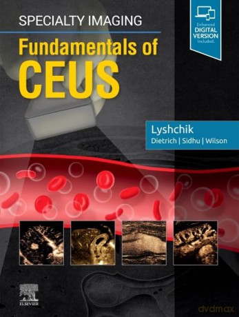 Specialty Imaging: Fundamentals of CEUS - Andrej Lyshchik [KSIĄŻKA]