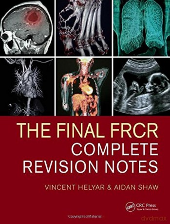 The Final FRCR: Complete Revision Notes - Vincent Helyar [KSIĄŻKA]
