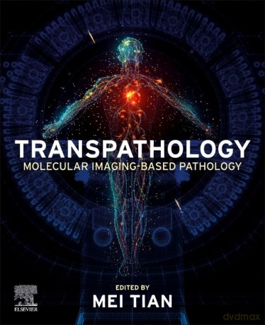 Transpathology: Molecular Imaging-Based Pathology - Mei Tian [KSIĄŻKA]