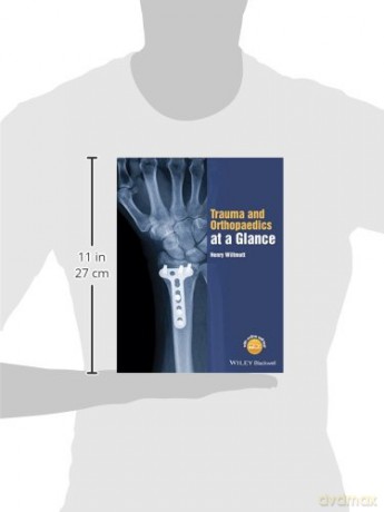 Trauma and Orthopaedics at a Glance [KSIĄŻKA]