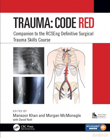 Trauma: Code Red: Companion to the RCSEng Definitive Surgical Trauma Skills Course - Mansoor Khan [KSIĄŻKA]