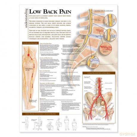 Understanding Low Back Pain Anatomical Chart - Anatomical Chart [KSIĄŻKA]