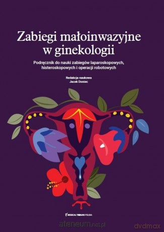 Zabiegi małoinwazyjne w ginekologii - dr n. med. Jacek Doniec [KSIĄŻKA]