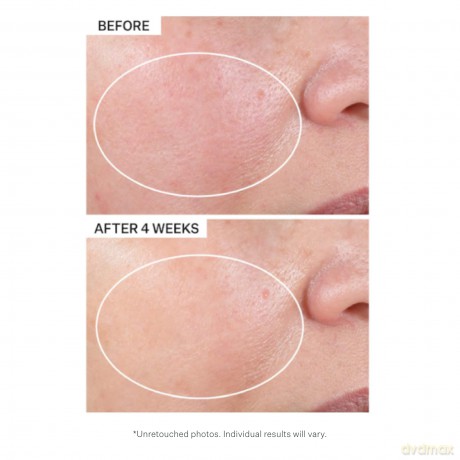 StriVectin Advanced Retinol (Intensive Night Moisturizer) 50 ml dla kobiety