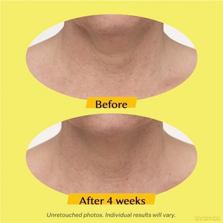 StriVectin Advanced Lifting Neck and Decollete Cream (Tightening Neck Cream Plus) - Volume: 30 ml dla kobiety