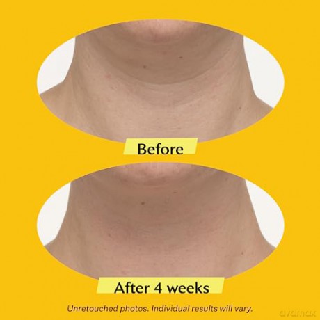 StriVectin Advanced Lifting Neck and Decollete Cream (Tightening Neck Cream Plus) - Volume: 30 ml dla kobiety