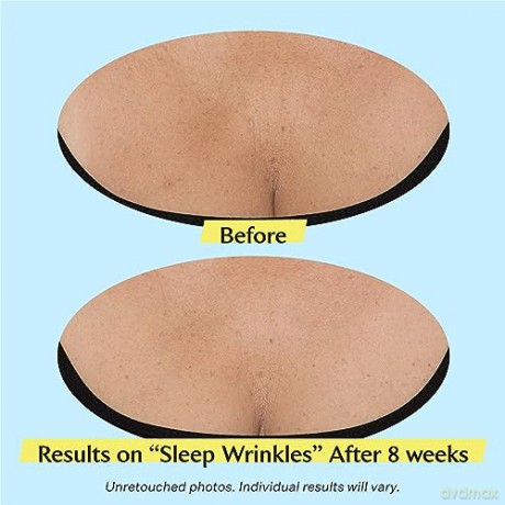 StriVectin Advanced Lifting Neck and Decollete Cream (Tightening Neck Cream Plus) - Volume: 30 ml dla kobiety