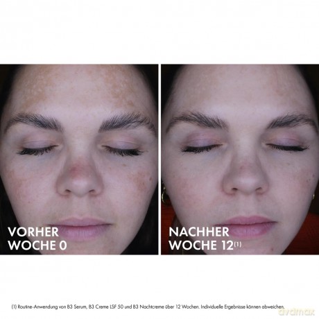 Vichy Day cream against pigment spots SPF 50 Liftactiv B3 Anti-Dark Spots 50 ml dla kobiety