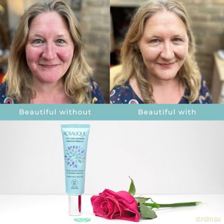 ROSALIQUE Cream against skin redness 3 in 1 Anti-Redness Miracle Formula SPF 50 30 ml dla kobiety