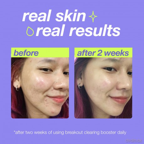 Dermalogica Clear Start Skin Serum (Breakout Clearing Booster) 30 ml dla kobiety