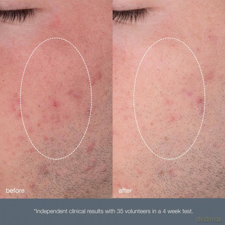 Dermalogica Daily skin peeling (Daily Microfoliant) 13 ml dla kobiety