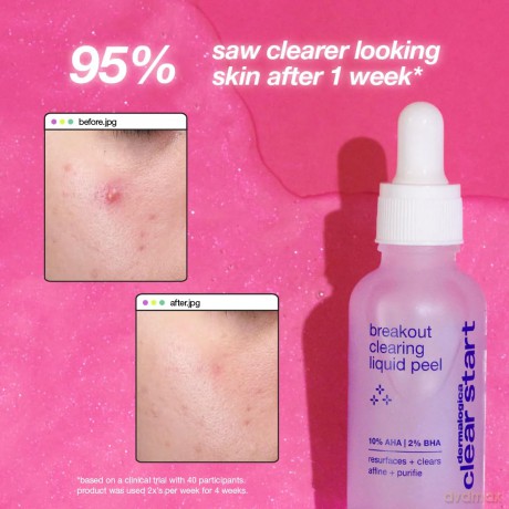 Dermalogica Unifying peeling against skin hyperpigmentation Clear Start (Breakout Clearing Liquid Peel) 30 ml dla kobiety