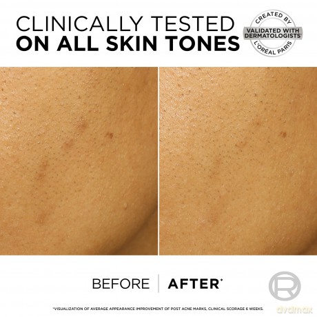 L´Oréal Paris Exfoliating peeling against dark spots Bright Reveal (Dark Spot Exfoliant Peel) 25 ml dla kobiety