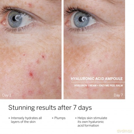 Babor Skin serum in ampoules with hyaluronic acid Power Serum (Hyaluronic Acid Ampoules) 7 x 2 ml dla kobiety