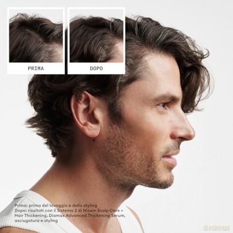Nioxin System 2 care set for fine, significantly thinning natural hair unisex