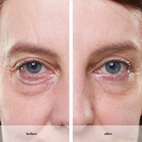 Avon Smoothing care for the eye area with an immediate effect Anew Platinum (Instant Eye Smoother) 15 ml dla kobiety