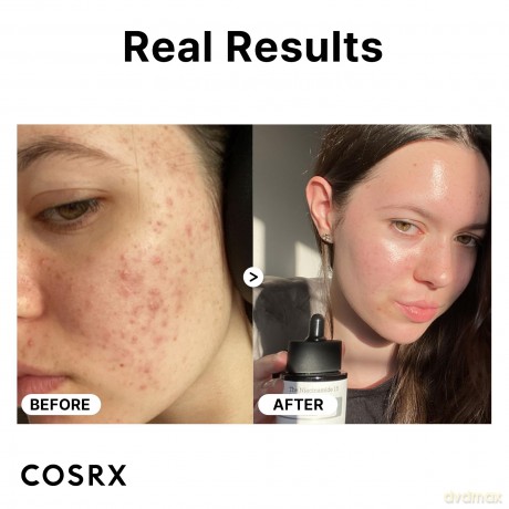 COSRX Skin serum The Niacinamide 15 (Serum) 20 ml dla kobiety