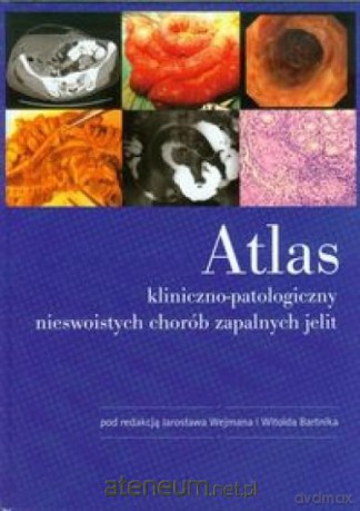 Atlas kliniczno-patologiczny nieswoistych chorób [KSIĄŻKA]