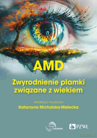 AMD Zwyrodnienie plamki żółtej związane z wiekiem - Katarzyna Michalska-Małecka [KSIĄŻKA]